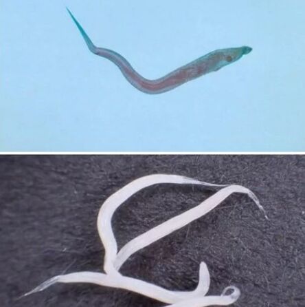 Types of parasites in the human body