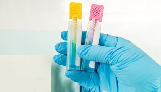 Parasit Diagnostics methods