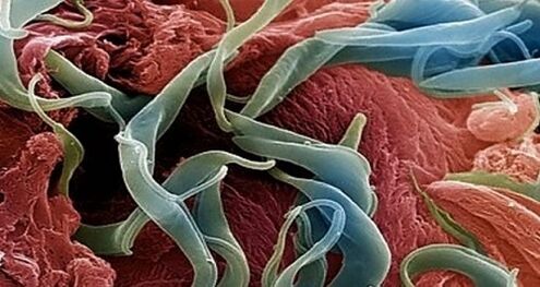Photo of parasites in the human body